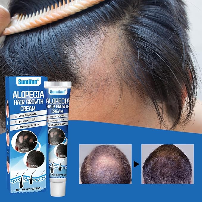 Hair Growth Cream - Echo Bloom