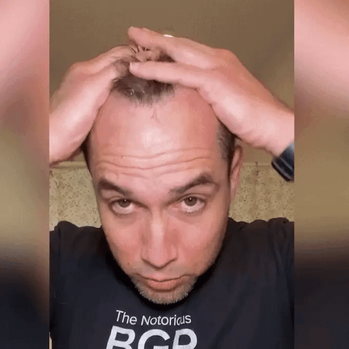 Hair Growth Spray - Echo Bloom