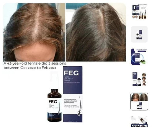 Hair Growth Spray - Echo Bloom
